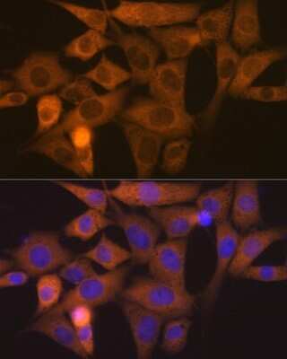 Immunocytochemistry/ Immunofluorescence: NCK1 Antibody (4R1N9) [NBP3-16759]