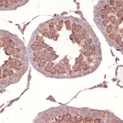 Immunohistochemistry-Paraffin: NCK1 Antibody (4R1N9) [NBP3-16759]