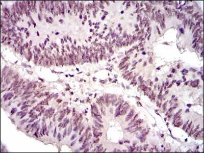 Immunohistochemistry: NCK1 Antibody (5B7) - BSA Free [NBP2-37490]