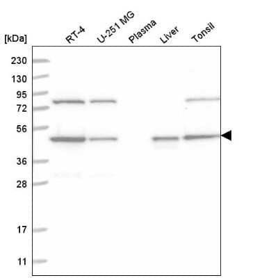 Western Blot: NCK1 Antibody [NBP2-55255]