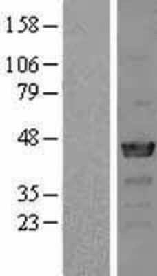 Western Blot: NCK2 Overexpression Lysate [NBL1-13512]