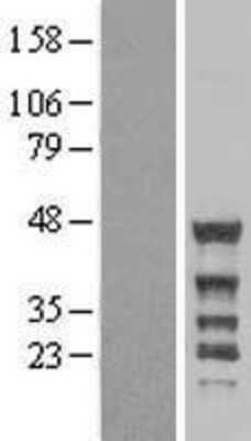 Western Blot: NCK2 Overexpression Lysate [NBL1-13513]