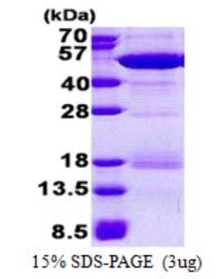 SDS-PAGE: Recombinant Human NCK2 His Protein [NBP2-23272]