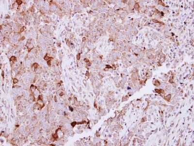 Immunohistochemistry-Paraffin: NCKAP1 Antibody [NBP2-19491]