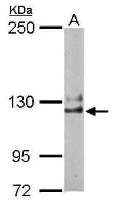 Western Blot: NCKAP1 Antibody [NBP1-32339]