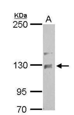 Western Blot: NCKAP1 Antibody [NBP1-32339]