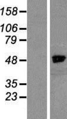 Western Blot: NCKAP1 Overexpression Lysate [NBP2-07394]