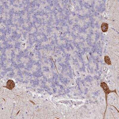 Immunohistochemistry-Paraffin: NCKAP5 Antibody [NBP1-90474]