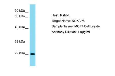 Western Blot: NCKAP5 Antibody [NBP2-85361]