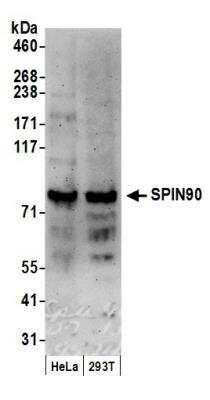 Western Blot: NCKIPSD Antibody [NBP1-42664]