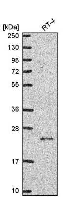 Western Blot: NCKIPSD Antibody [NBP2-56886]