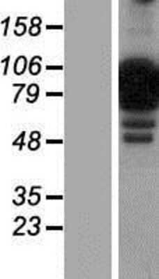 Western Blot: NCKIPSD Overexpression Lysate [NBP2-04774]