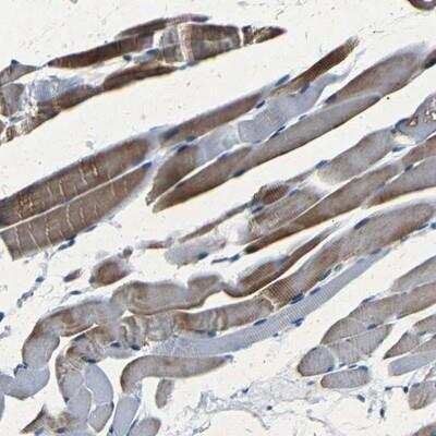 Immunohistochemistry: NCMAP Antibody [NBP1-93768]