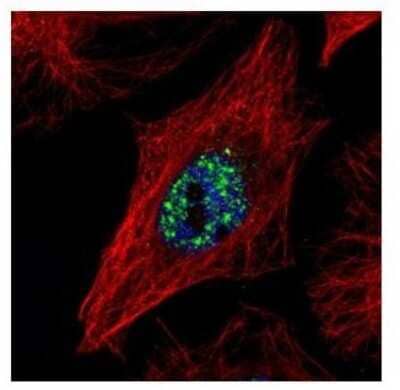 Immunocytochemistry/ Immunofluorescence: NCOA2 Antibody [NBP2-19495]