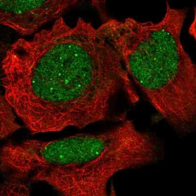 Immunocytochemistry/ Immunofluorescence: NCOA2 Antibody [NBP2-55879]