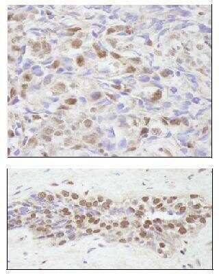 Immunohistochemistry: NCOA2 Antibody [NB100-1756]