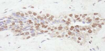 Immunohistochemistry: NCOA2 Antibody [NB100-1756]