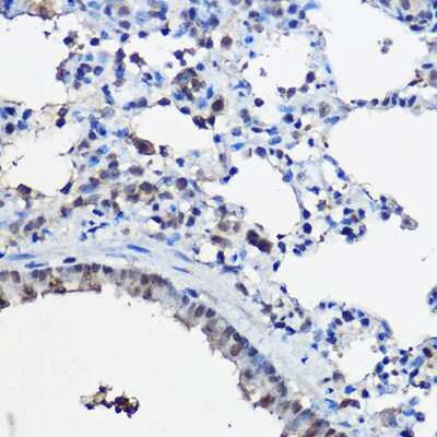 Immunohistochemistry-Paraffin: NCOA2 Antibody - BSA Free [NBP3-03763]