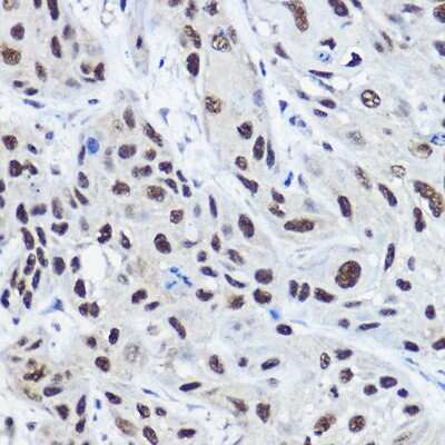 Immunohistochemistry-Paraffin: NCOA2 Antibody - BSA Free [NBP3-03763]