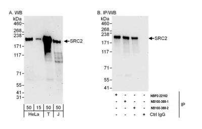 Immunoprecipitation: NCOA2 Antibody [NB100-388]
