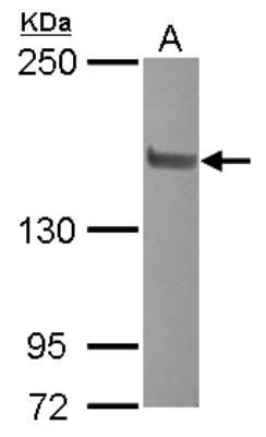 Western Blot: NCOA2 Antibody [NBP2-19495]