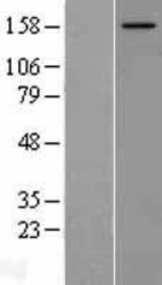 Western Blot: NCOA2 Overexpression Lysate [NBL1-13516]