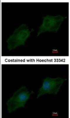 Immunocytochemistry/ Immunofluorescence: NCOA3/AIB1 Antibody [NBP1-33720]