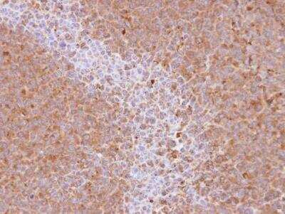 Immunohistochemistry-Paraffin: NCOA3/AIB1 Antibody [NBP1-33720]