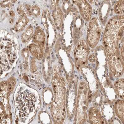 Immunohistochemistry-Paraffin: NCOA3/AIB1 Antibody [NBP1-90256]