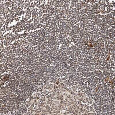 Immunohistochemistry-Paraffin: NCOA3/AIB1 Antibody [NBP1-90256]