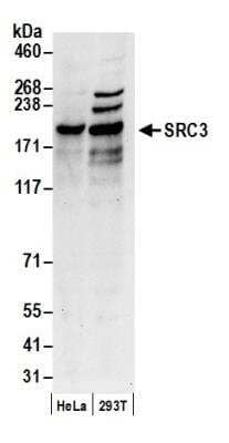 Western Blot: NCOA3/AIB1 Antibody [NB100-314]