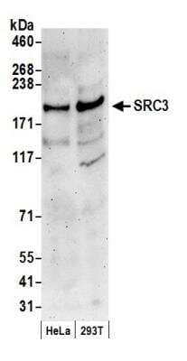Western Blot: NCOA3/AIB1 Antibody [NB100-315]