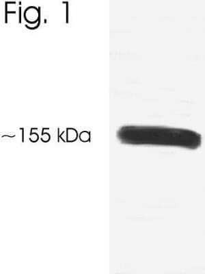 Western Blot: NCOA3/AIB1 Antibody [NB300-567]