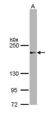 Western Blot: NCOA3/AIB1 Antibody [NBP1-33720]