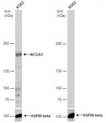 Western Blot: NCOA3/AIB1 Antibody [NBP1-33720]