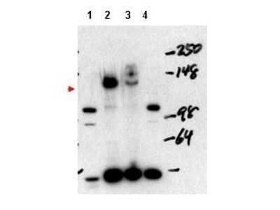 Western Blot: NCOA3/AIB1 Antibody [NBP1-77785]