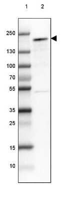 Western Blot: NCOA3/AIB1 Antibody [NBP1-90256]