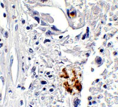 Immunohistochemistry-Paraffin: NCOA4 Antibody - BSA Free [NBP3-18136]
