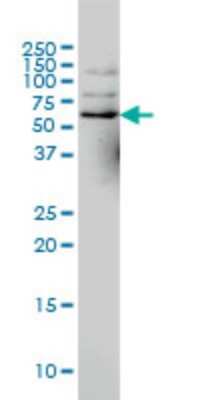 Western Blot: NCOA4 Antibody (1A2) [H00008031-M02]