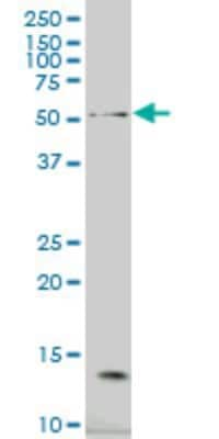 Western Blot: NCOA4 Antibody (1F11) [H00008031-M05]