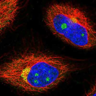 Immunocytochemistry/ Immunofluorescence: NCOA4 Antibody [NBP2-56237]