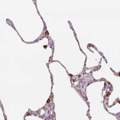 Immunohistochemistry: NCOA4 Antibody [NBP2-39048]