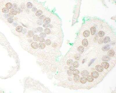 Immunohistochemistry-Paraffin: NCOA4 Antibody [NBP1-28681]