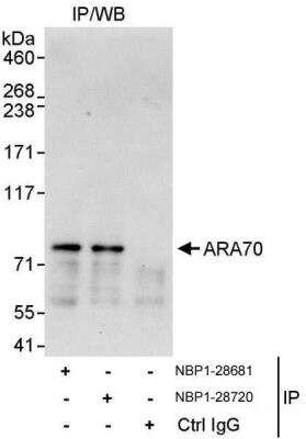 Immunoprecipitation: NCOA4 Antibody [NBP1-28681]