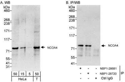 Western Blot: NCOA4 Antibody [NBP1-28720]