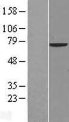 Western Blot: NCOA4 Overexpression Lysate [NBL1-13518]