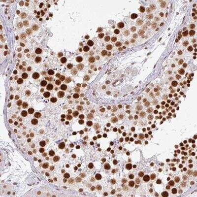 Immunohistochemistry-Paraffin: NCOA5 Antibody [NBP2-47361]
