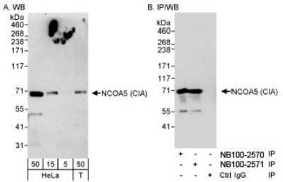 Western Blot: NCOA5 Antibody [NB100-2570]