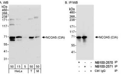 Western Blot: NCOA5 Antibody [NB100-2571]