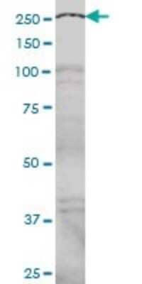 Western Blot: NCOA6 Antibody (2D7) [H00023054-M01]